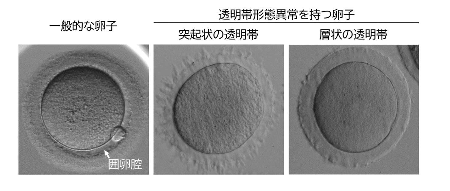二次元　受精　妊娠 